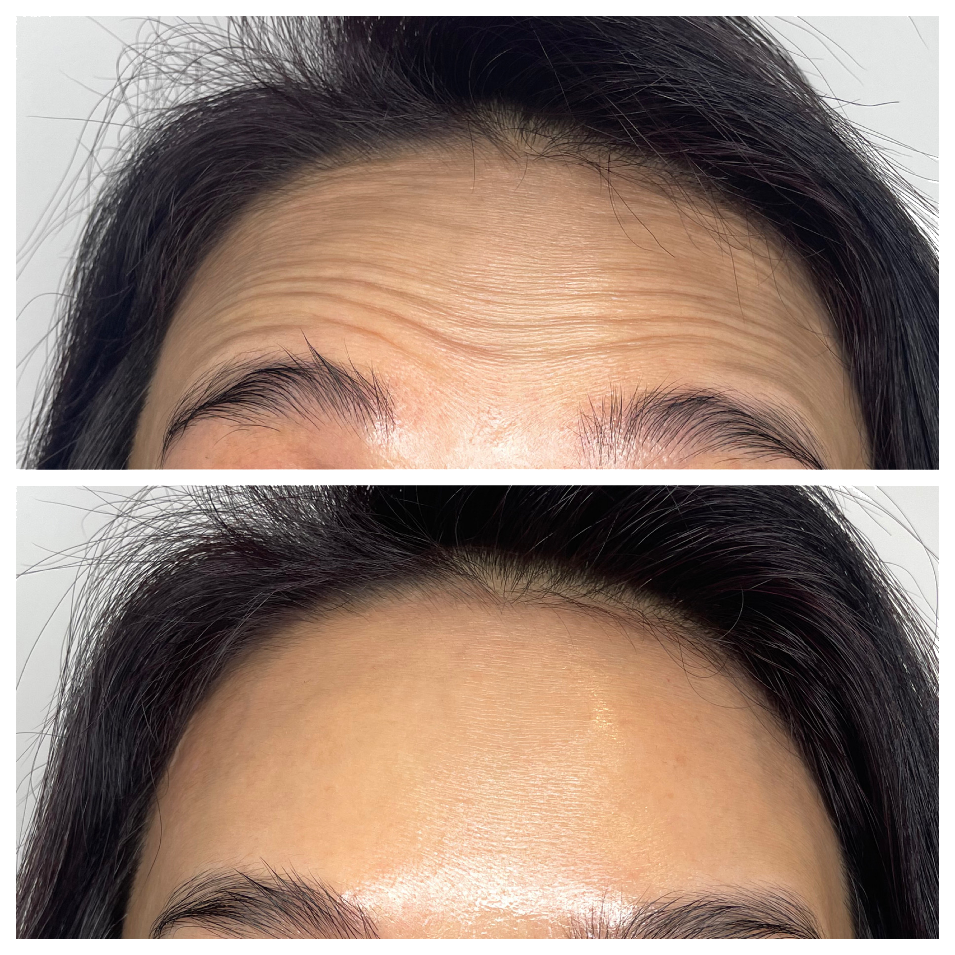 Expert advanced practitioners providing skin rejuvenation treatments at Neat Studio with Botox and Dysport and more like Daxxify.