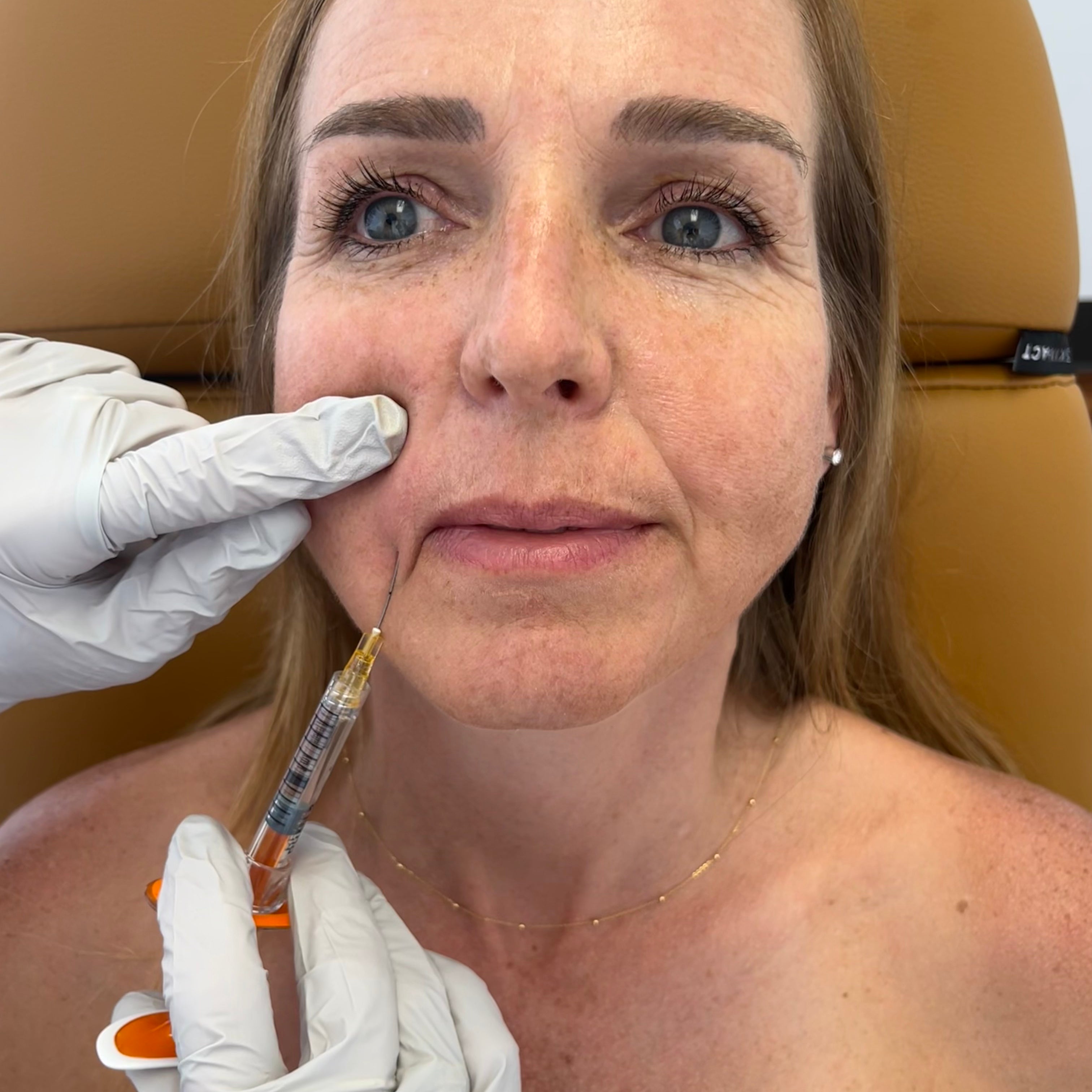 Non-surgical cosmetic dermatology treatments including lip filler, chin, and jawline filler at Neat Studio for wrinkle reduction