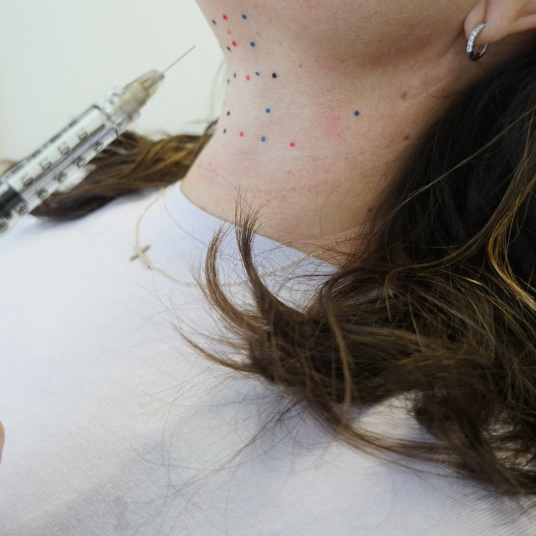 Kybella fat-dissolving treatment at Neat Studio to target and reduce stubborn chin fat for a more contoured, slim appearance