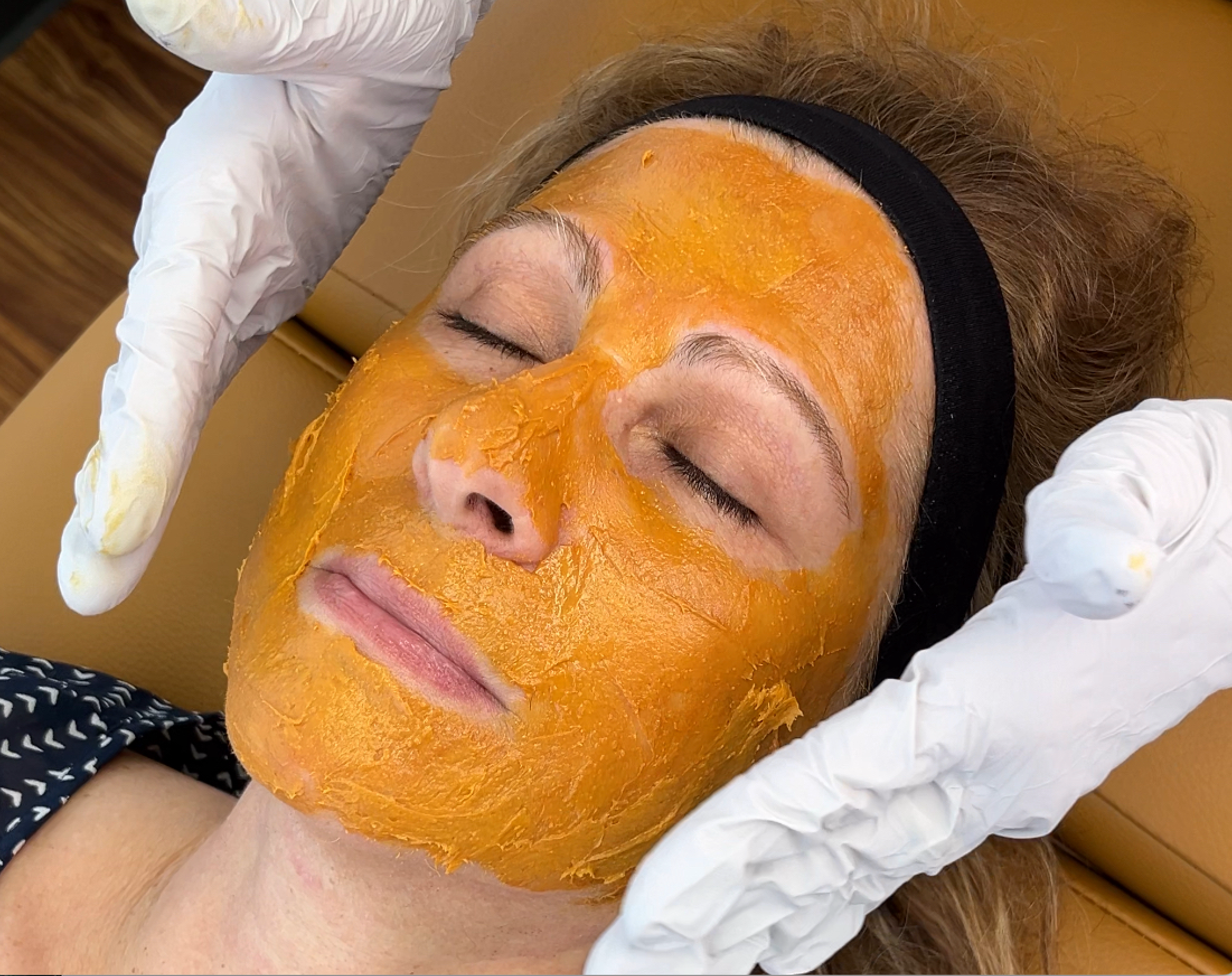 Chemical peel at Neat Studio for exfoliating dead skin, improving texture, and revealing a smoother, brighter complexion.